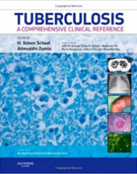 Image of TUBERCULOSIS: A COMPREHENSIVE CLINICAL REFERENCE