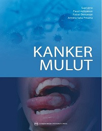 KANKER MULUT