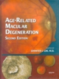 AGE-RELATED MACULAR DEGENERATION