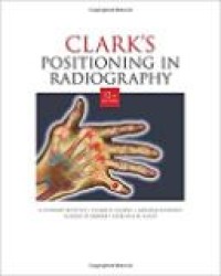 CLARK'S POSITIONING IN RADIOGRAPHY